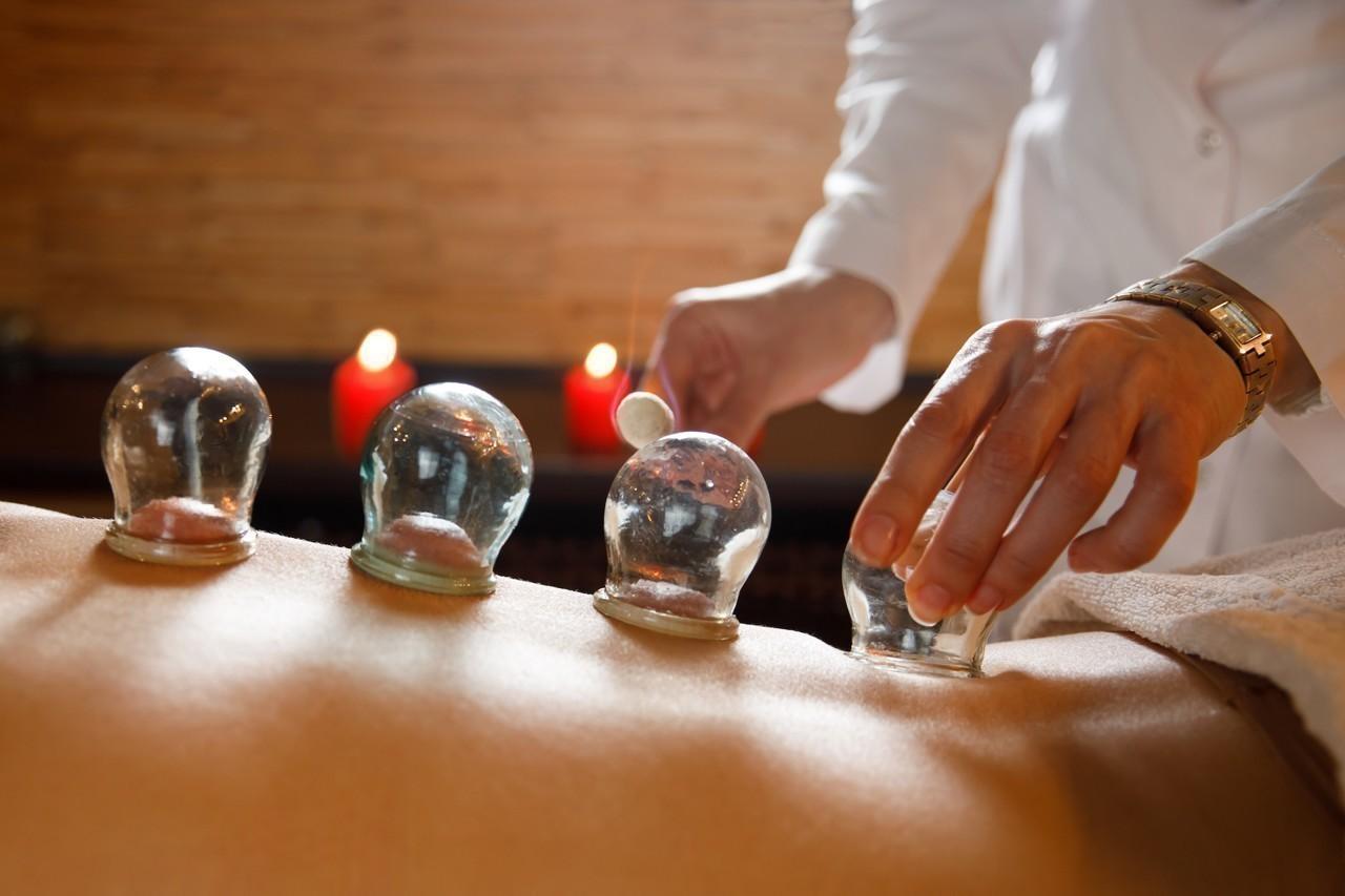 How can cupping help with back pain?
